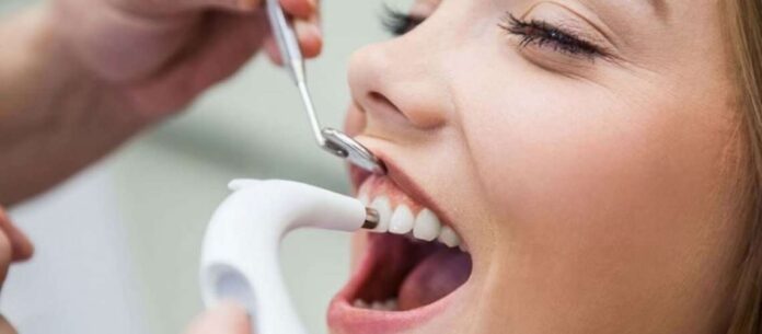 Tooth Scaling And Polishing