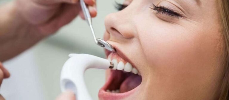7 Benefits of Regular Professional Cleaning for Healthy Teeth